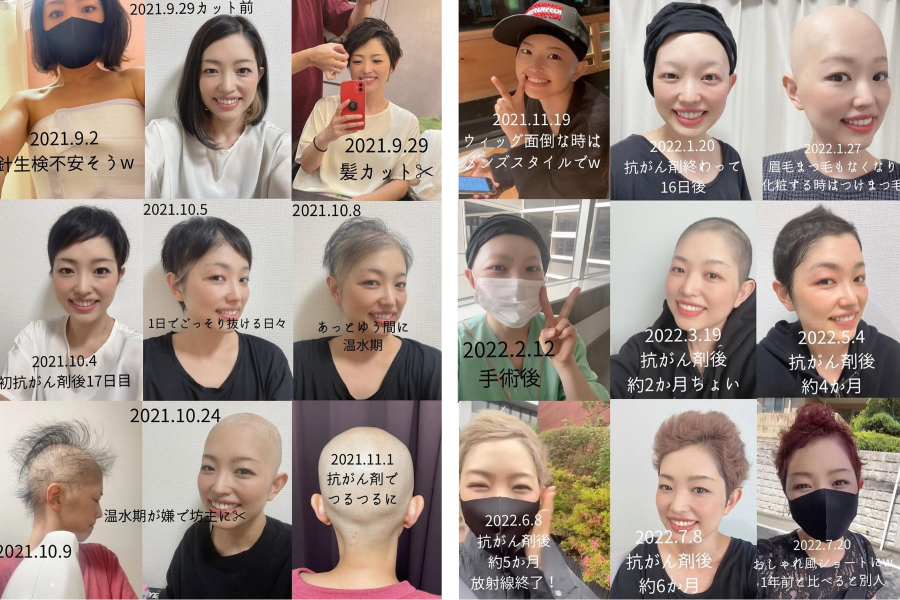 EMIさんの治療の経過（EMIさんのインスタグラムより）