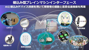 植込み型ブレインマシンインターフェース