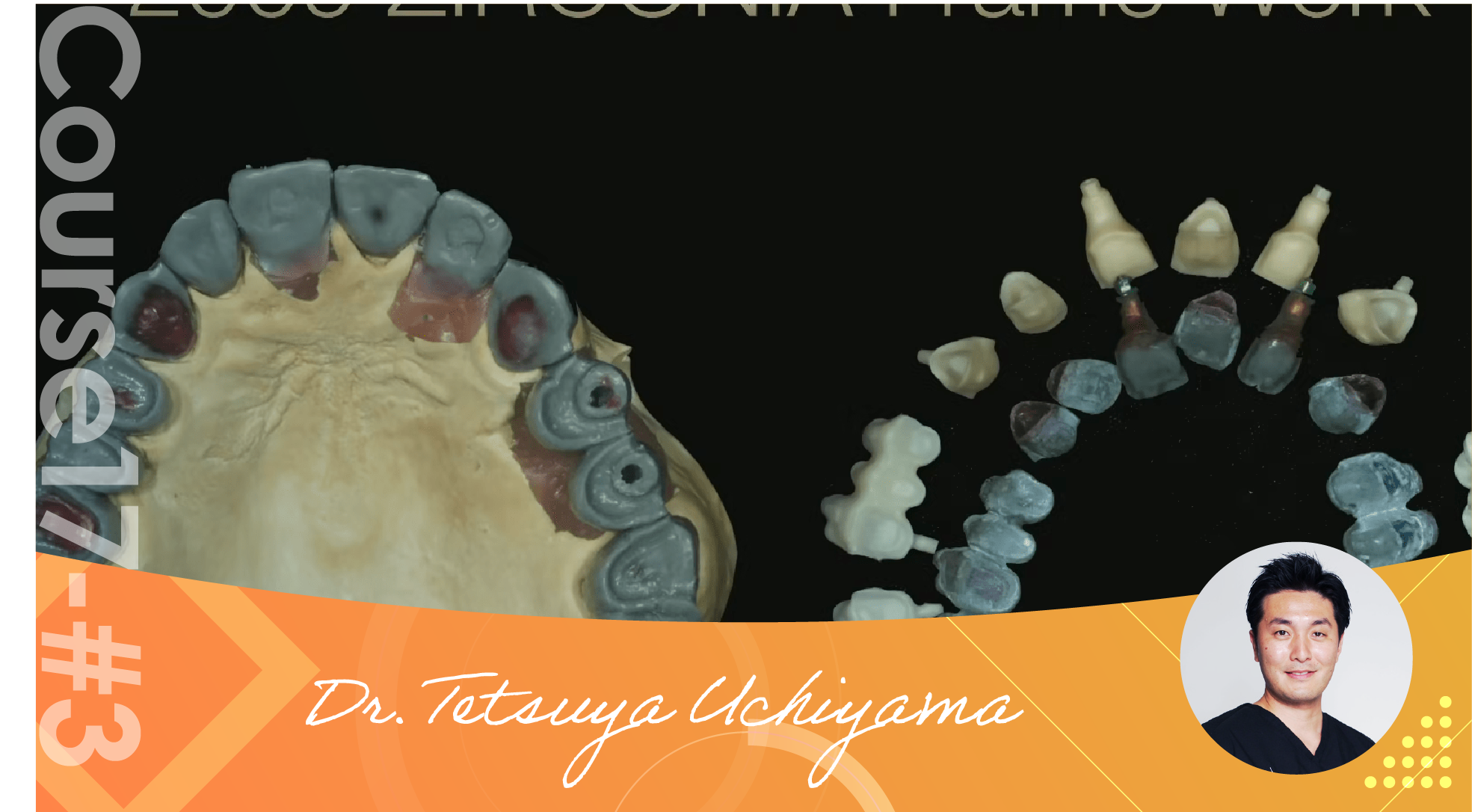 3 Indications for Zirconia Crown Doctorbook global academy