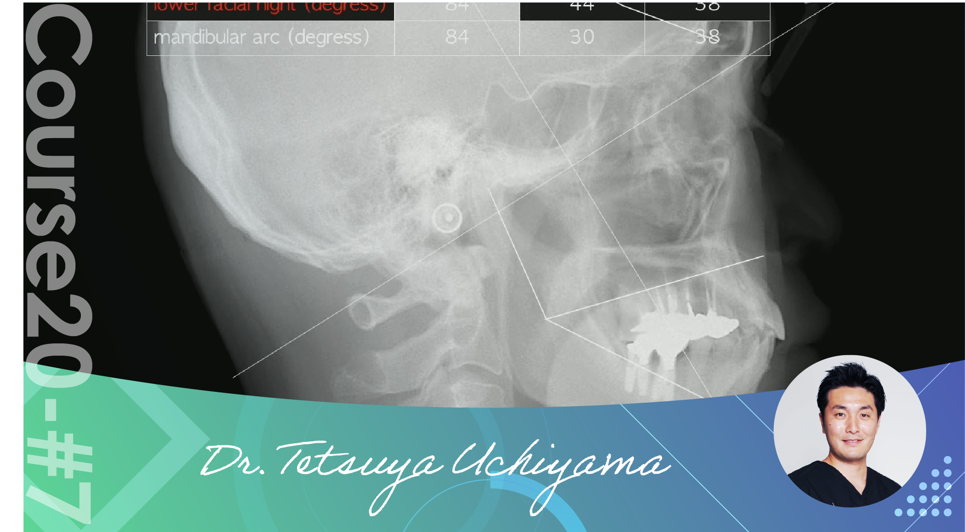 7-classification-of-prosthetic-treatment-by-maxillo-facial-analysis